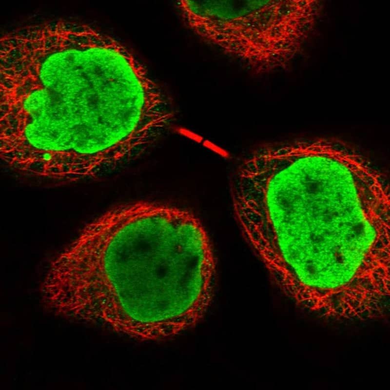 Staining of human cell line A-431 shows localization to nucleoplasm.