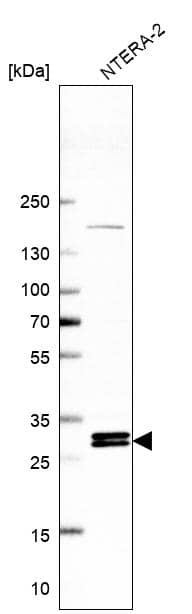 Analysis in human cell line NTERA-2.