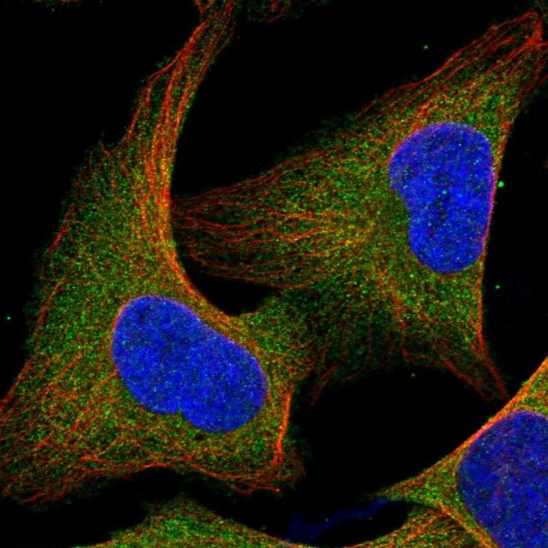 Staining of human cell line U-2 OS shows localization to cytosol.