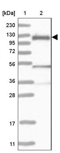 Lane 1: Marker [kDa] 230, 130, 95, 72, 56, 36, 28, 17, 11Lane 2: Human cell line RT-4