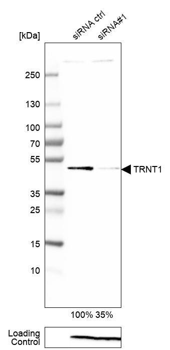 Western Blot TRNT1 Antibody - BSA Free