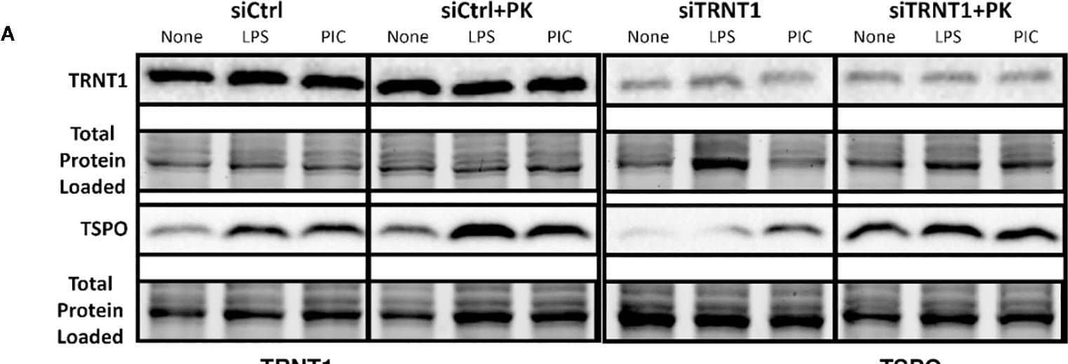 Western Blot TRNT1 Antibody - BSA Free