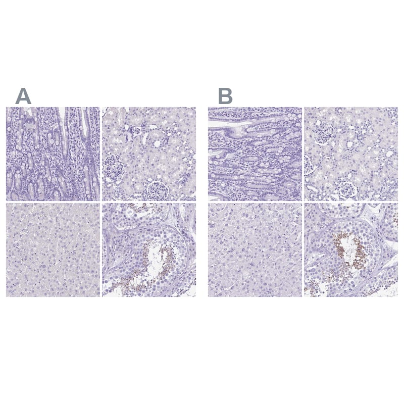 <b>Orthogonal Strategies Validation. </b>Staining of human gastrointestinal, kidney, liver and testis HPA040046 (A) shows similar protein distribution across tissues to independent antibody HPA039359 (B).
