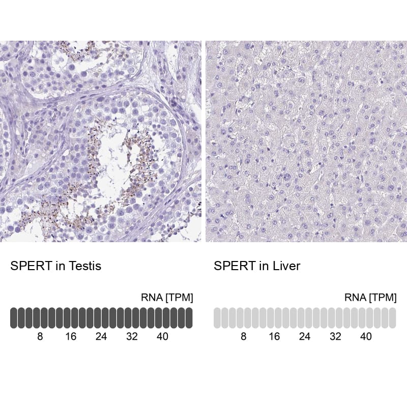 <b>Orthogonal Strategies Validation. </b>Analysis in human testis and liver tissues Corresponding SPERT RNA-seq data are presented for the same tissues.