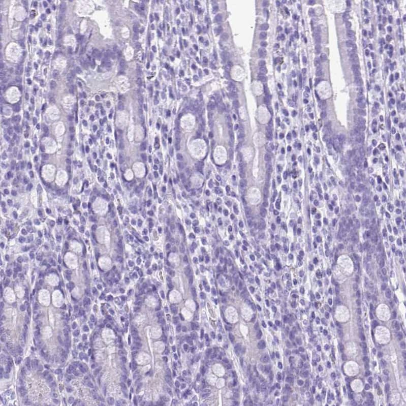 Staining of human small intestine shows no positivity in glandular cells as expected.