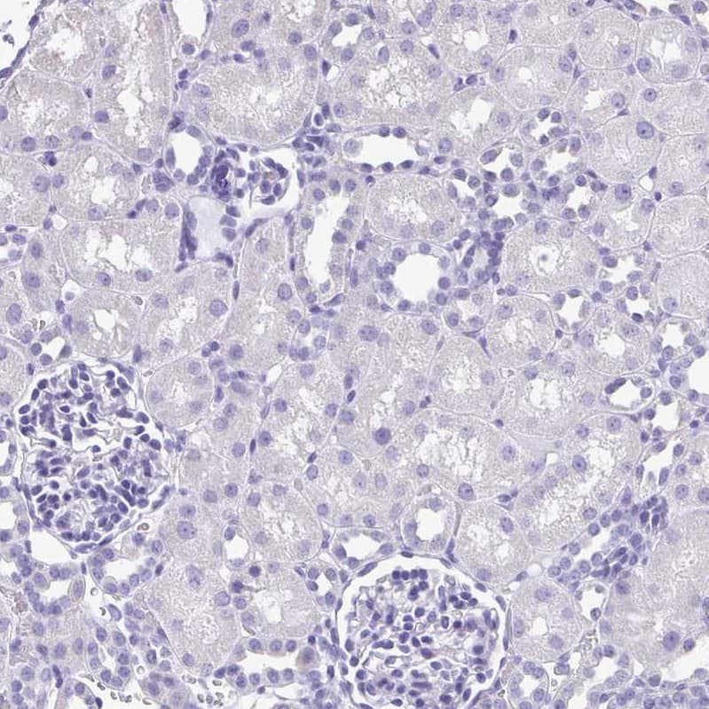 Staining of human kidney shows no positivity in cells in tubules as expected.
