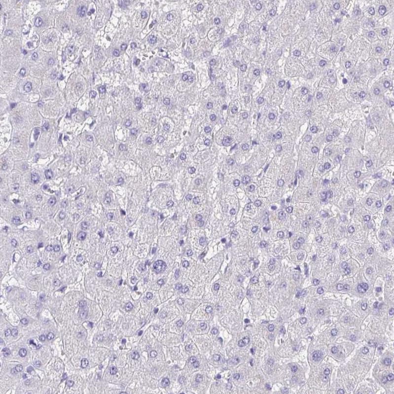 Staining of human liver shows no positivity in hepatocytes as expected.