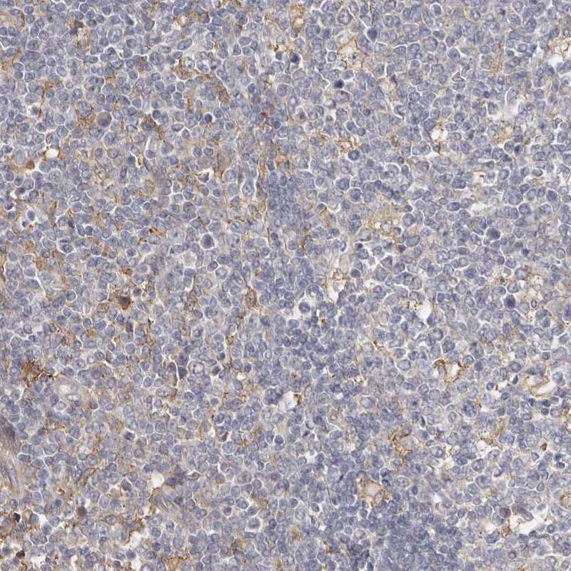 Staining of human tonsil shows negative to very weak positivity in non-germinal center cells.
