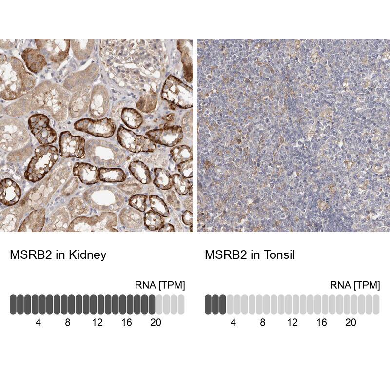 <b>Orthogonal Strategies Validation. </b>Analysis in human kidney and tonsil tissues Corresponding MSRB2 RNA-seq data are presented for the same tissues.