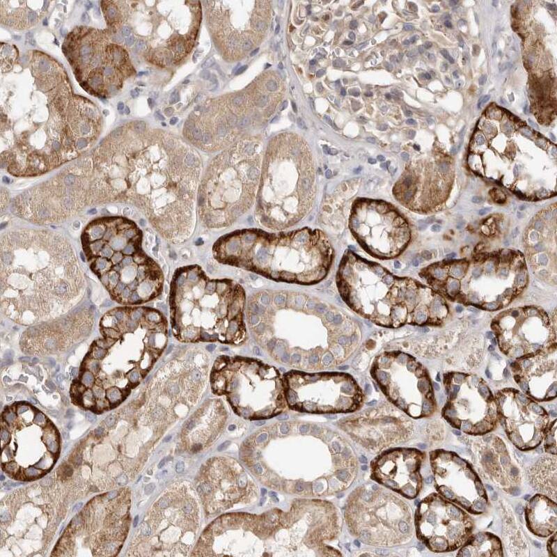 Staining of human kidney shows moderate to strong cytoplasmic positivity in cells in tubules.