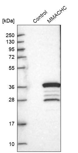 Analysis in control (vector only transfected HEK293T lysate) and MMACHC over-expression lysate (Co-expressed with a C-terminal myc-DDK tag (~3.1 kDa) in mammalian HEK293T cells).