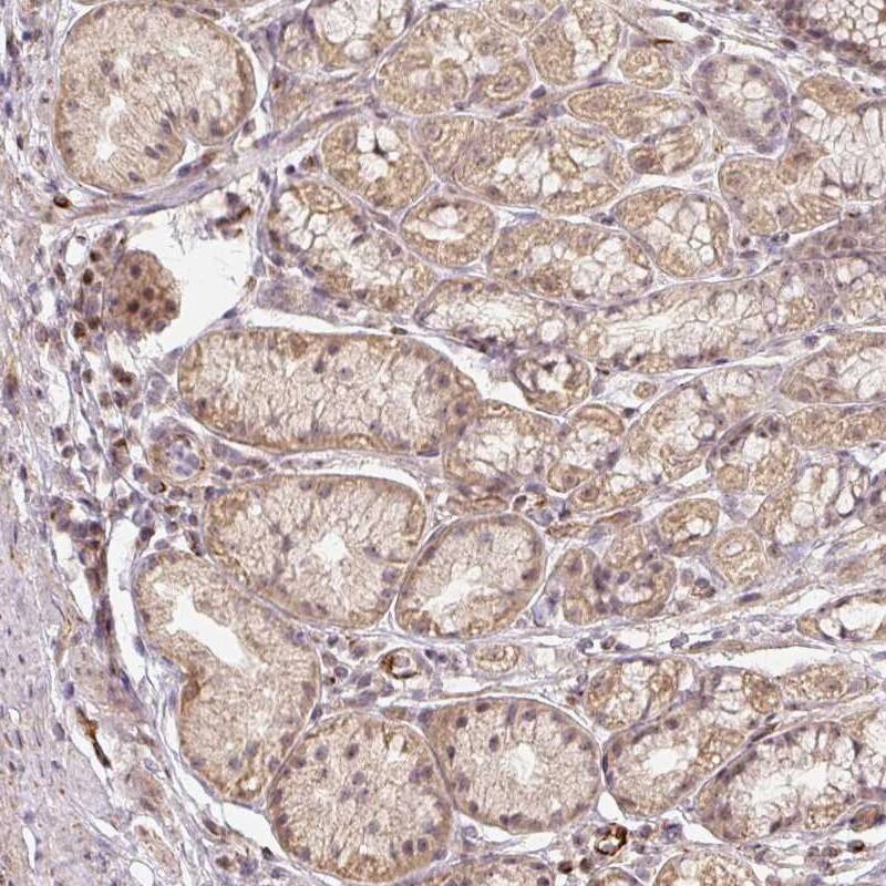 Staining of human stomach, lower shows moderate cytoplasmic and nucleolar positivity in glandular cells.