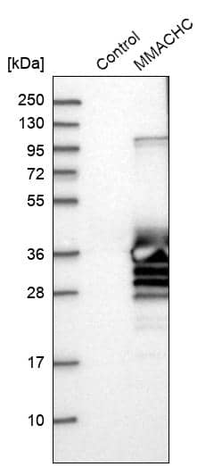 Analysis in control (vector only transfected HEK293T lysate) and MMACHC over-expression lysate (Co-expressed with a C-terminal myc-DDK tag (~3.1 kDa) in mammalian HEK293T cells).