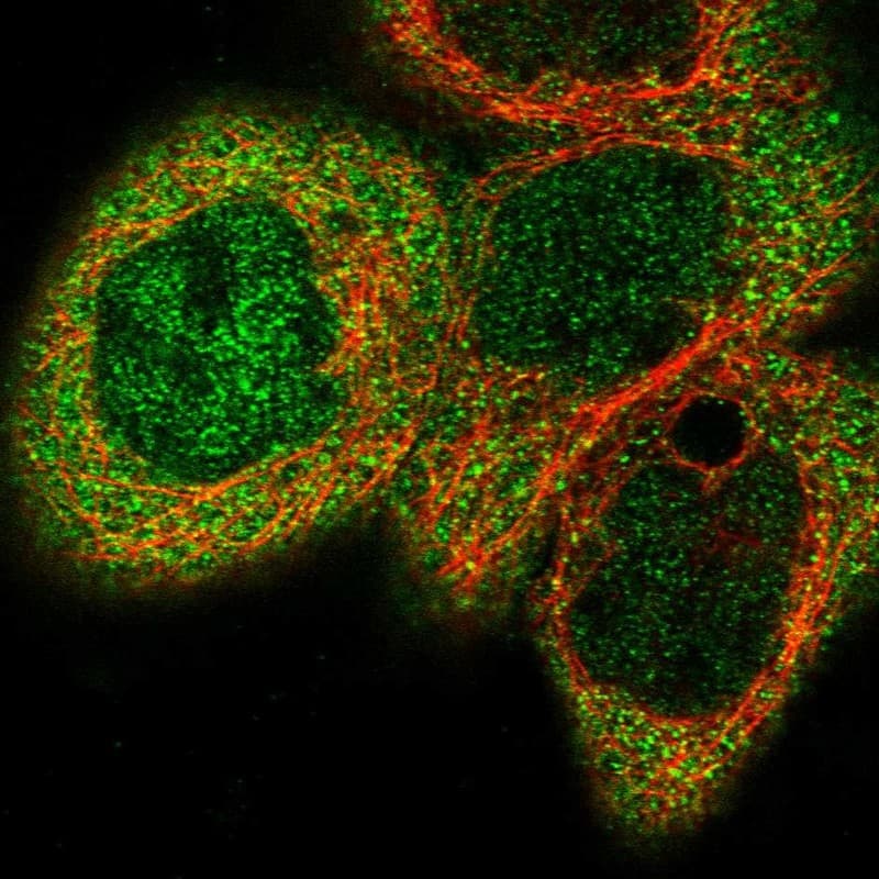 Staining of human cell line A-431 shows localization to nucleoplasm & cytosol.