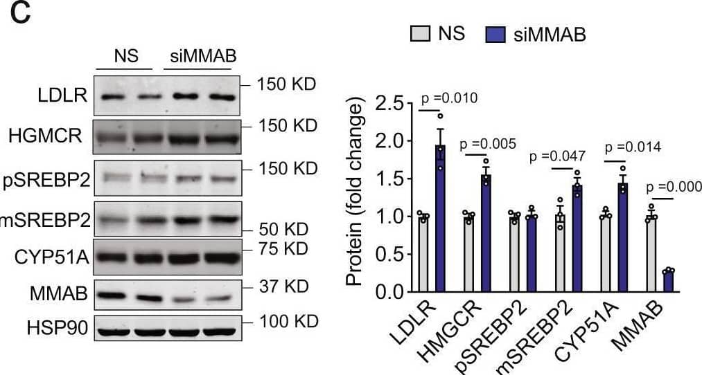 Knockdown of MMAB increases LDLR expression and activity and decreases cholesterol biosynthesis in vitro.a Representative images of DiI-LDL uptake in Huh7 cells transfected with a non-silencing siRNA (NS) or siRNA MMAB (siMMAB) and incubated with 30 μg/ml DiI-LDL for 8 h at 37 C. Red, DiI-LDL; blue, nuclei stained with TO-PRO-3 iodide (TOPRO). Scale bar, 10 μm. Flow cytometry analysis of DiI-LDL specific binding and uptake in Huh7 cells transfected with NS siRNA or siMMAB and incubated with 30 μg/ml DiI-LDL for 8 h at 37 C (uptake) or 90 min at 4 C (binding) is shown below. Data are mean +/- s.e.m. of three independent experiments. Statistical comparisons by two-sided unpaired Student’s t test. b, c qRT-PCR (b) and Western analysis (c) of SREBP2-responsive genes in Huh7 cells transfected with an NS control siRNA or siMMAB. HSP90 was used as a loading control. Quantification compared to HSP90 is shown in panel (c). Data are mean +/- s.e.m. of three (c) or four (b) independent experiments in duplicate. Statistical comparisons by two-sided unpaired Student’s t test. d Sterol content of Huh7 cells transfected with NS siRNA or siMMAB. Lipids were extracted and analyzed by GC-MS. “Total sterols