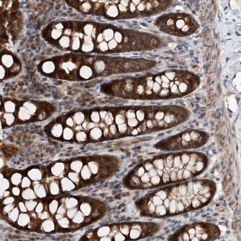 Immunohistochemistry-Paraffin MMAA Antibody - BSA Free