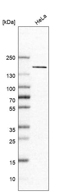 Analysis in human cell line HeLa.