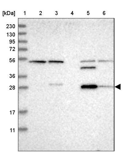 Lane 1: Marker [kDa] 230, 130, 95, 72, 56, 36, 28, 17, 11Lane 2: Human cell line RT-4Lane 3: Human cell line U-251MG spLane 4: Human plasma (IgG/HSA depleted)Lane 5: Human liver tissueLane 6: Human tonsil tissue