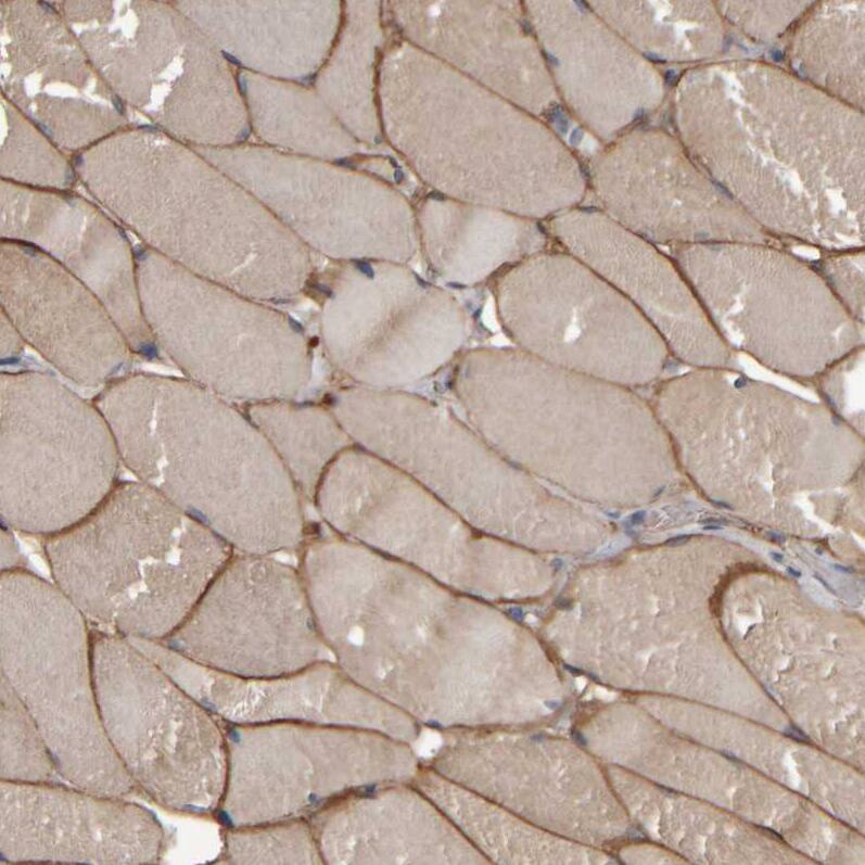 Immunohistochemistry-Paraffin MURC Antibody - BSA Free