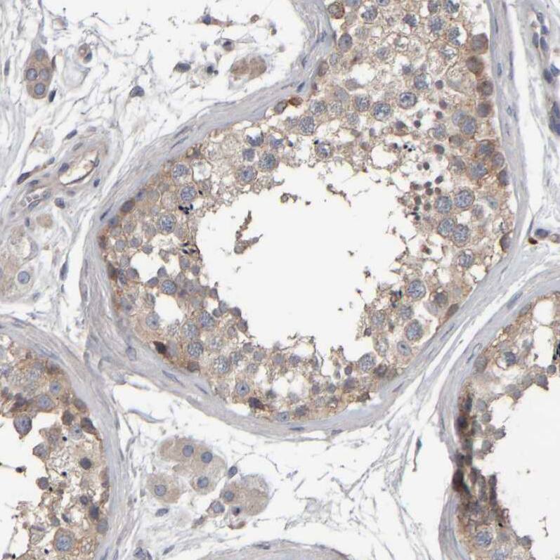 Immunohistochemistry-Paraffin MURC Antibody - BSA Free