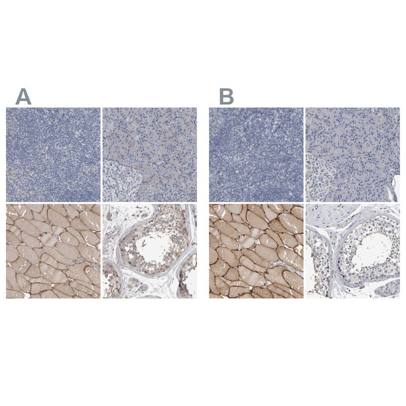 Immunohistochemistry-Paraffin MURC Antibody - BSA Free
