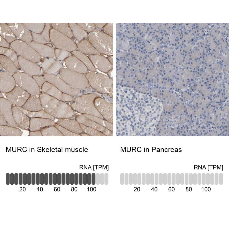 Immunohistochemistry-Paraffin MURC Antibody - BSA Free