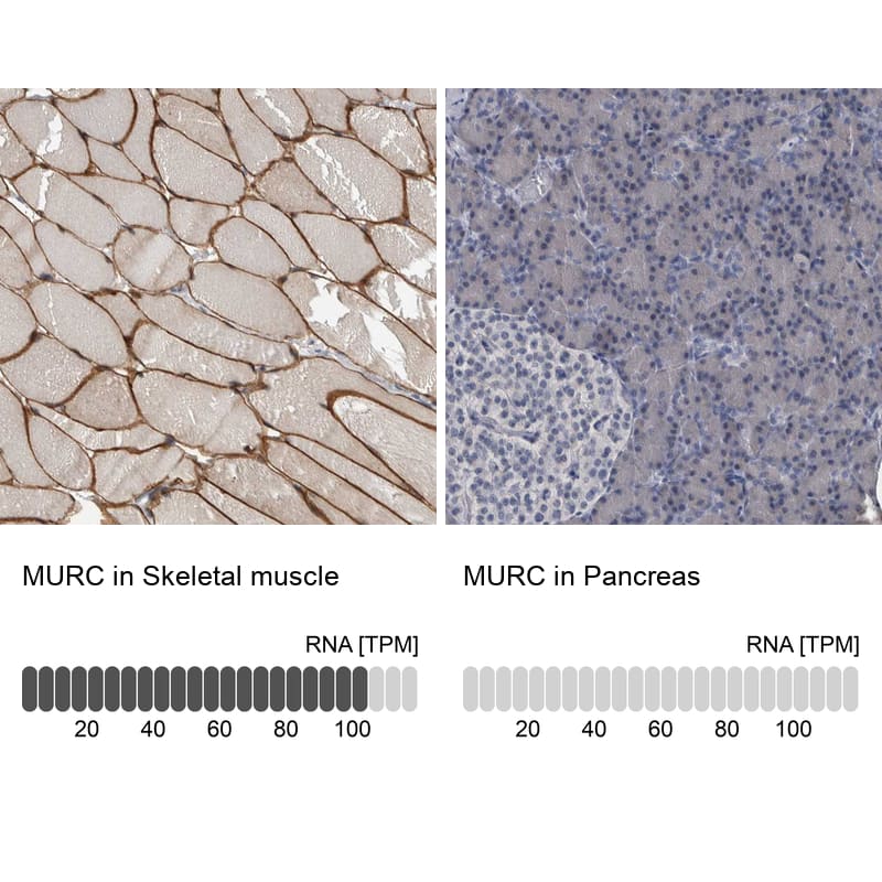 Immunohistochemistry-Paraffin MURC Antibody - BSA Free