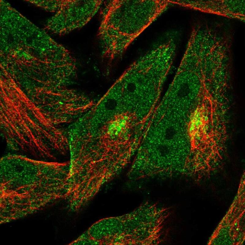 Staining of human cell line RH-30 shows localization to nucleoplasm, plasma membrane & the Golgi apparatus.