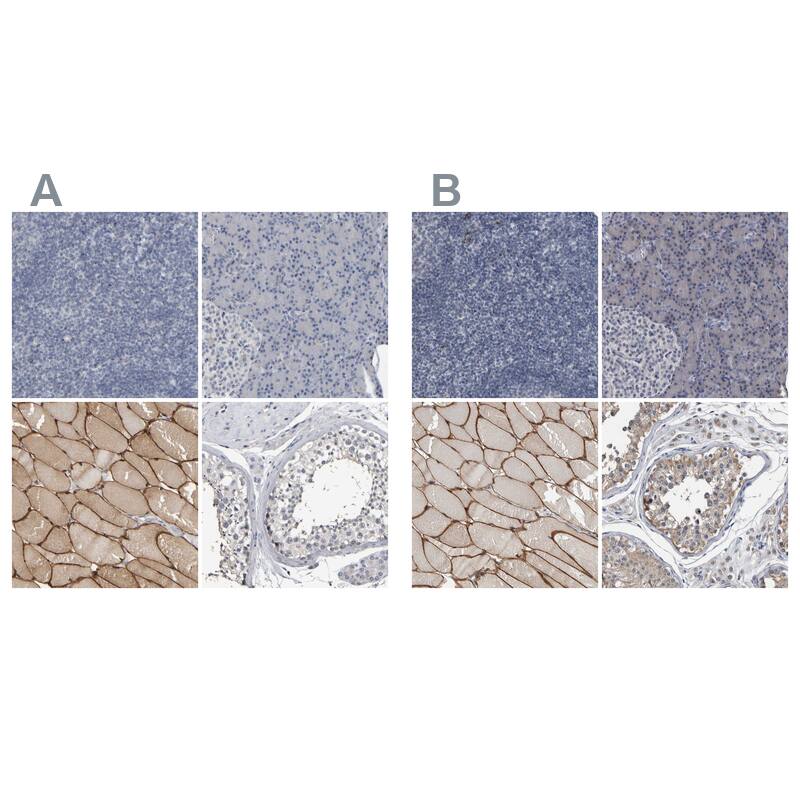 Immunohistochemistry-Paraffin MURC Antibody - BSA Free