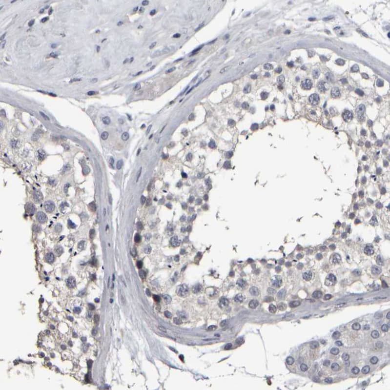 Staining of human testis shows weak cytoplasmic positivity in cells in seminiferous ducts.