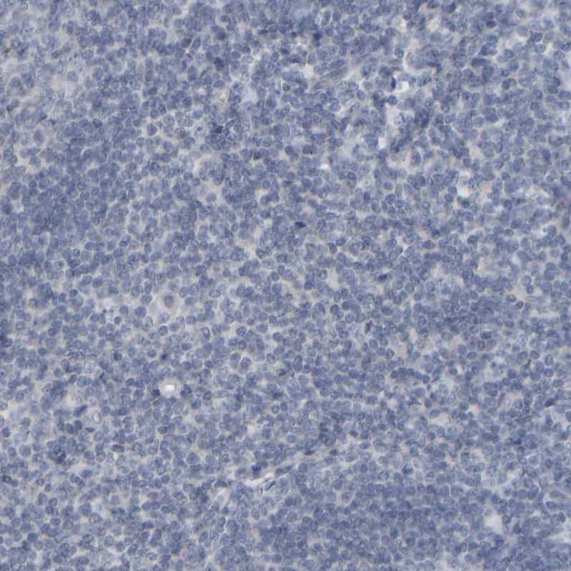 Staining of human tonsil shows no positivity in non-germinal center cells as expected.