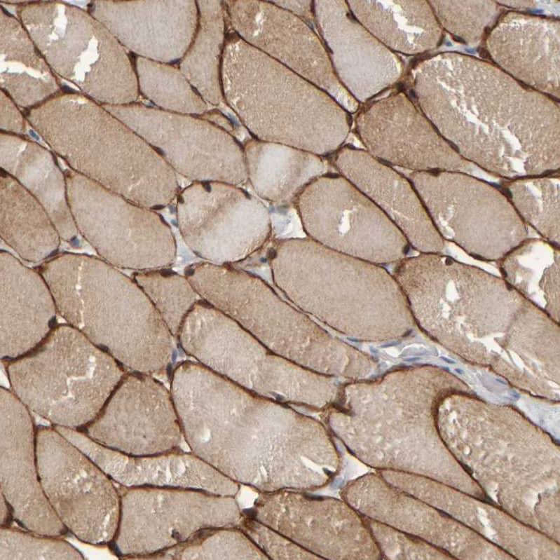 Staining of human skeletal muscle shows strong membranous positivity in myocytes.