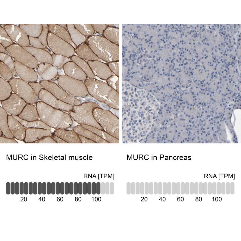 Analysis in human skeletal muscle and pancreas tissues Corresponding MURC RNA-seq data are presented for the same tissues.