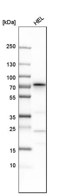 Analysis in human cell line HEL.