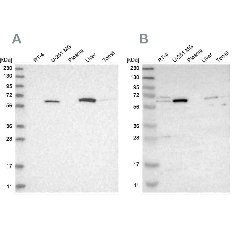 <b>Independent Antibodies Validation. </b>Analysis using Anti-CRAT antibody NBP1-86614 (A) shows similar pattern to independent antibody NBP1-86616 (B).