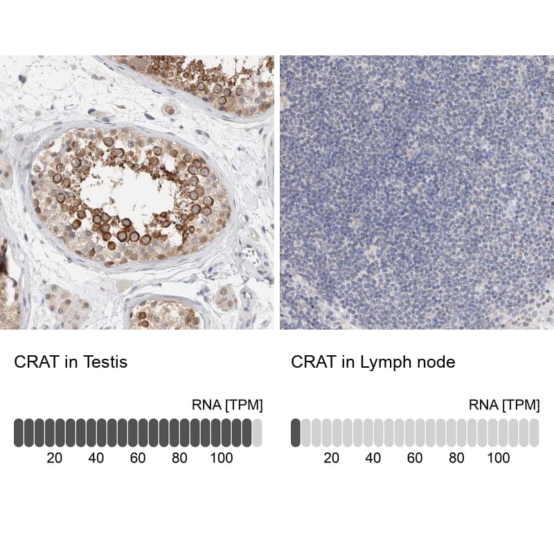 <b>Orthogonal Strategies Validation. </b>Analysis in human testis and lymph node tissues Corresponding CRAT RNA-seq data are presented for the same tissues.