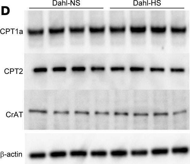 Salt-sensitive hypertension partially induces PTC carnitine deficiency with reduced plasma free Car.(A) Line graph shows systolic BP (mmHg) over time in Dahl-NS (n = 6), Dahl-HS (n = 7), and Dahl-HS+L-car (n = 6). (B) Plasma free Car (nmol/L) and (C) ratio of short-chain Acyl-C/middle-to-long-chain Acyl-C. (D) Western blots for CPT1a, CPT2, CrAT, and  beta -actin in the kidneys of Dahl-NS and Dahl-HS and (E) corresponding quantitation. n = 4, respectively. (F) Representative images for OCTN2 and (G) the corresponding quantitation for OCTN2+/HPF (%) in Dahl-NS (n = 6), Dahl-HS (n = 7), and Dahl-HS+L-car (n = 6). Scale bar, 50 μm. (H) Real-time PCR for Tmlhe in the kidneys of Dahl-NS and Dahl-HS. n = 4, respectively. (I) Representative images of Oil Red O staining, immunofluorescence staining for KIM-1, and Picrosirius red staining in Dahl-NS, Dahl-HS, and Dahl-HS+L-car. Scale bar, 50 μm. (J) The corresponding quantitation for Oil Red O+ area/cortex (%), KIM-1+/cortex (%), and collagen+ area/cortex (%). n = 4, respectively. Data are presented as means +/- SD. Unpaired, 2-tailed Student’s t test (B, C, E, and H) and 1-way ANOVA with Tukey’s post hoc test (G and J) were performed to determine P value. *P < 0.05, ***P < 0.001, ****P < 0.0001. NS, normal salt. Image collected and cropped by CiteAb from the following open publication (//pubmed.ncbi.nlm.nih.gov/40402578), licensed under a CC-BY license. Not internally tested by Novus Biologicals.