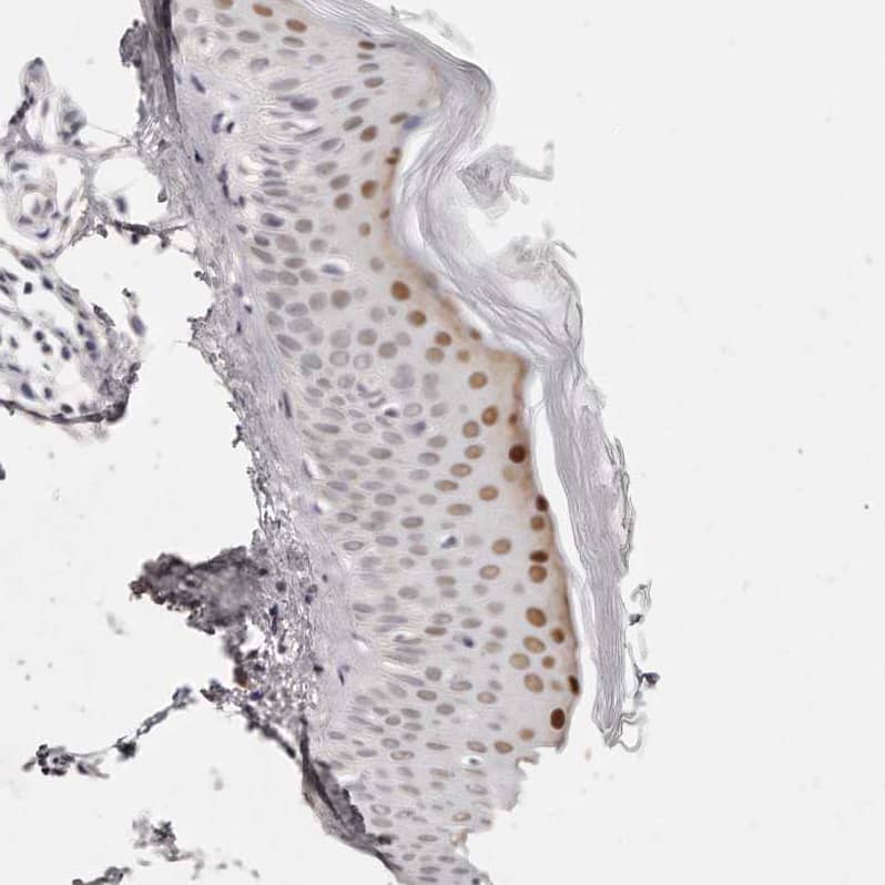 Immunohistochemistry-Paraffin CASZ1 Antibody - BSA Free