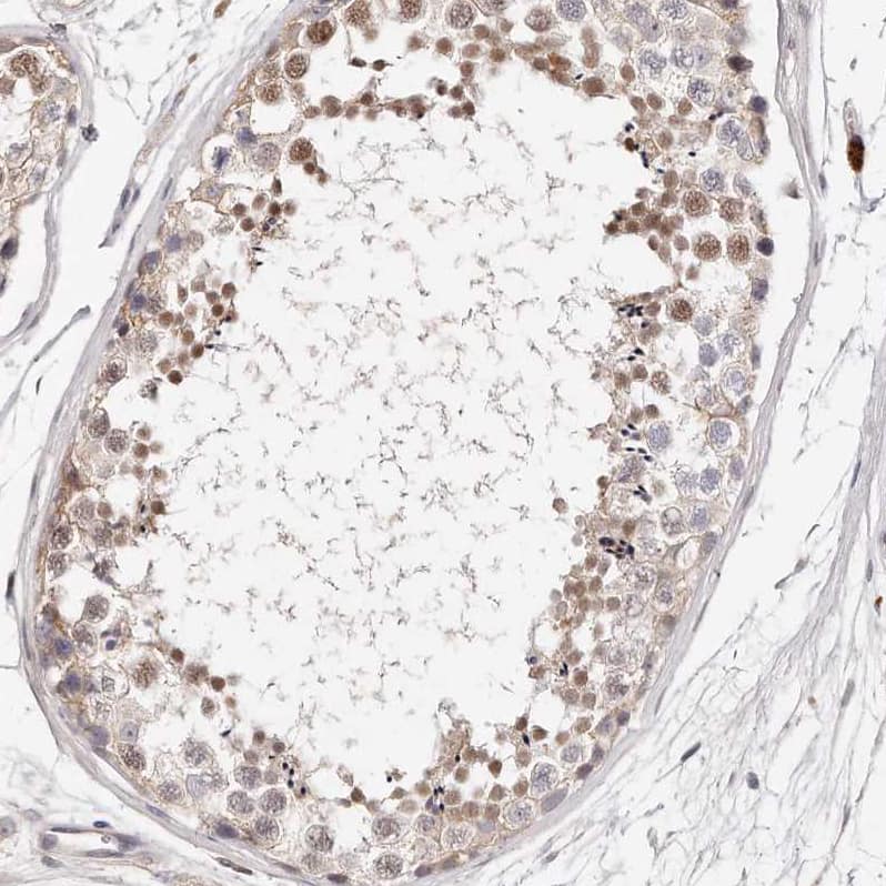 Immunohistochemistry-Paraffin CASZ1 Antibody - BSA Free