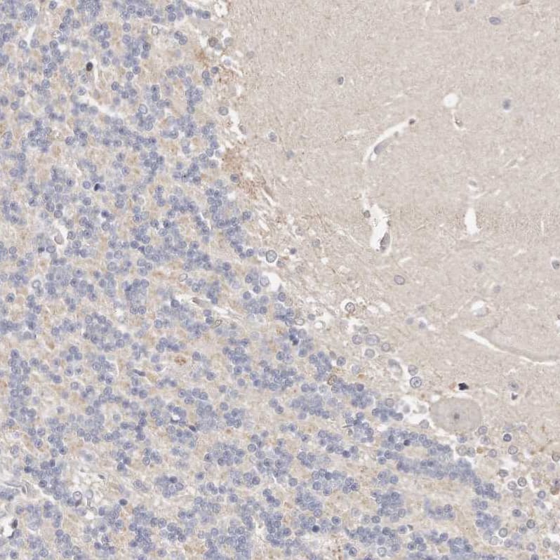Immunohistochemistry-Paraffin CASZ1 Antibody - BSA Free