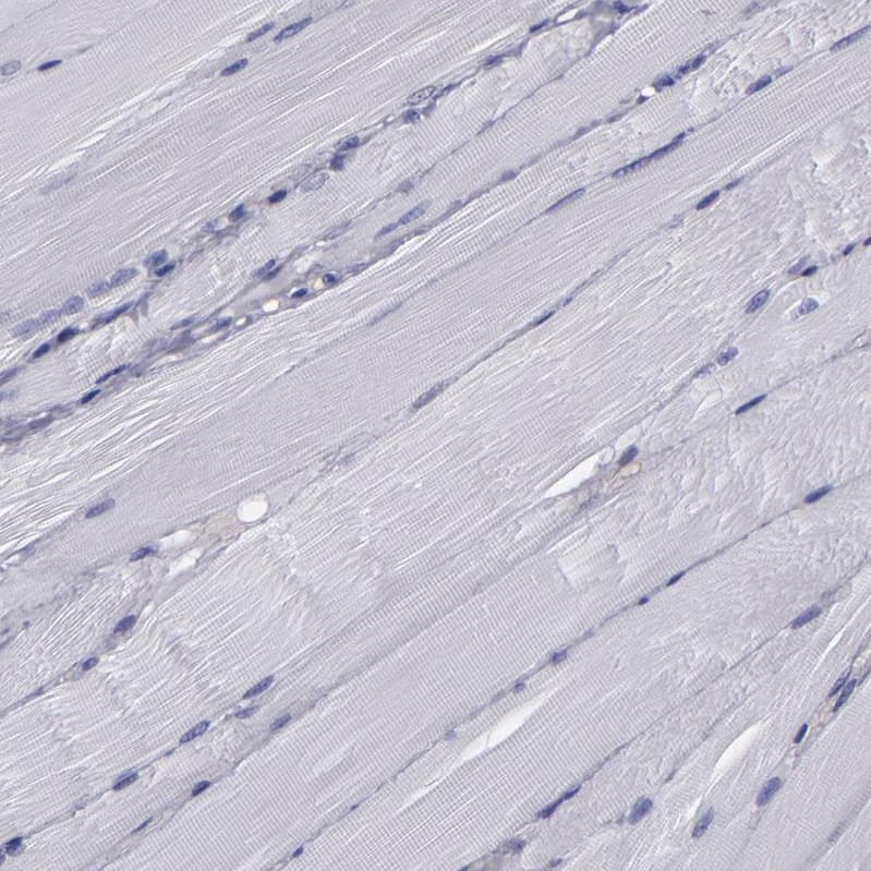 Immunohistochemistry-Paraffin CARS Antibody - BSA Free