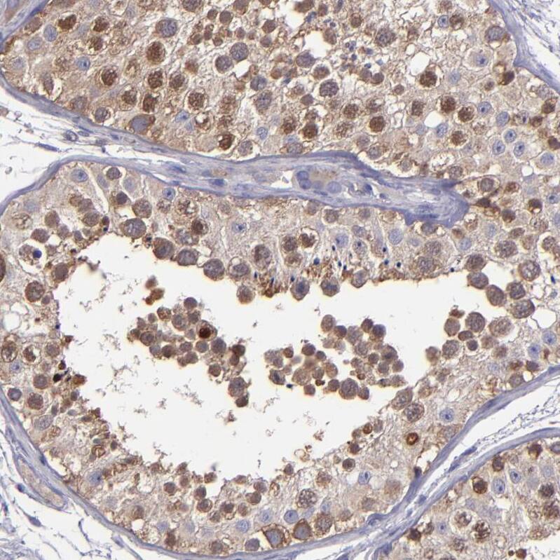 Staining of human testis shows strong cytoplasmic positivity in cells in seminiferous ducts.