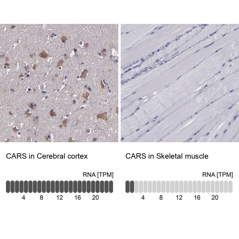Analysis in human cerebral cortex and skeletal muscle tissues. Corresponding RNA-seq data are presented for the same tissues.