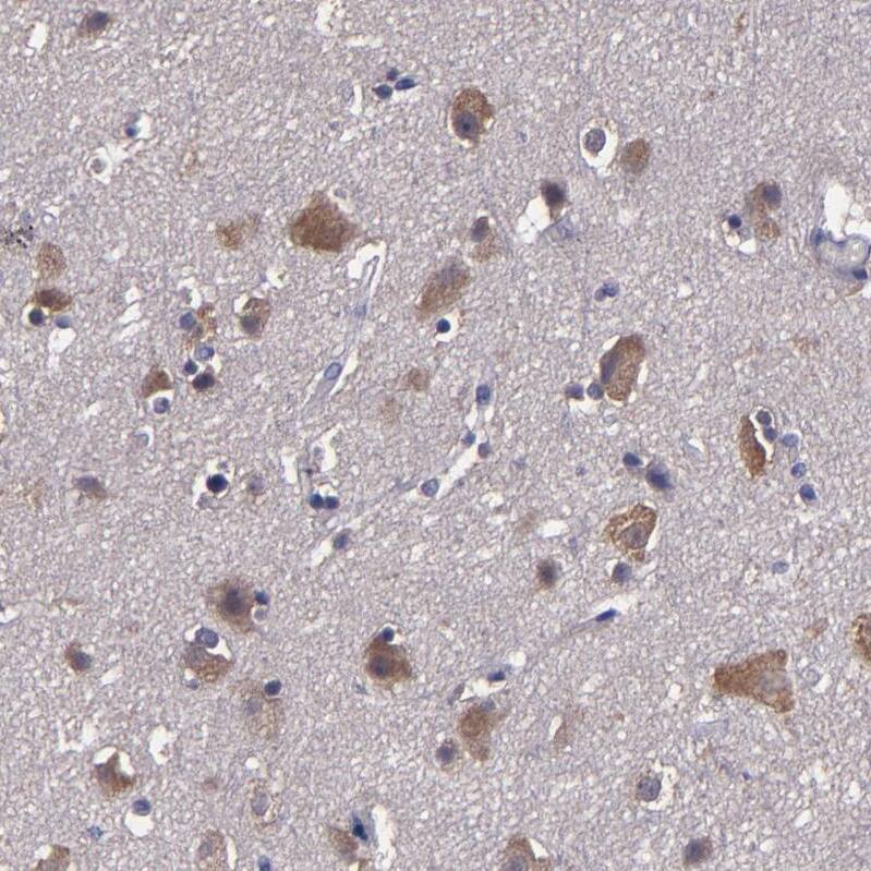 Staining of human cerebral cortex shows strong cytoplasmic positivity in neuronal cells.