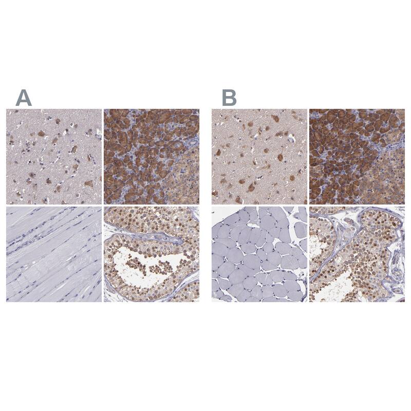 Staining of human cerebral cortex, pancreas, skeletal muscle and testis HPA002384 (A) shows similar protein distribution across tissues to independent antibody HPA002383 (B).