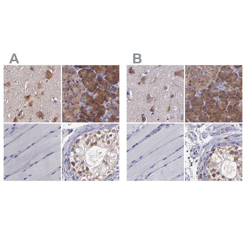 <b>Orthogonal Strategies Validation. </b>Staining of human cerebral cortex, pancreas, skeletal muscle and testis HPA002383 (A) shows similar protein distribution across tissues to independent antibody HPA002384 (B).