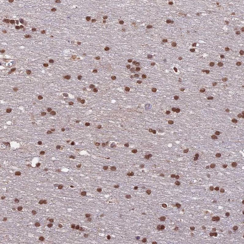 Immunohistochemistry-Paraffin CARF/CDKN2AIP Antibody - BSA Free