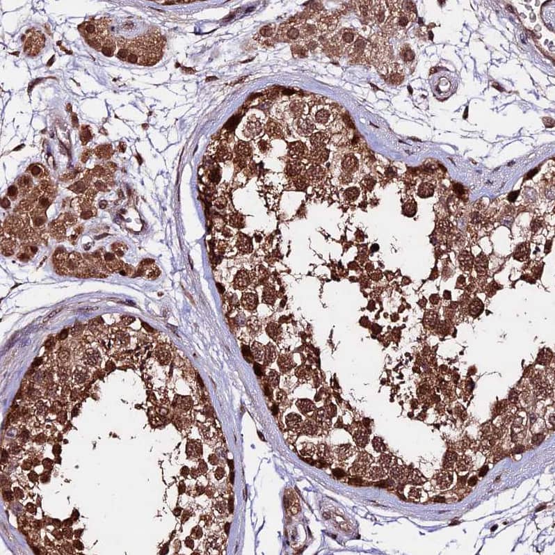 Staining of human testis shows strong nuclear and cytoplasmic positivity in cells in seminiferous ducts and leydig.