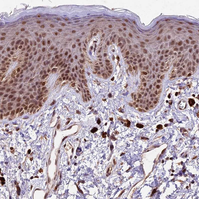 Staining of human skin shows moderate nuclear positivity in squamous epithelial cells.