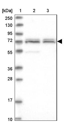 Lane 1: Marker [kDa] 250, 130, 95, 72, 55, 36, 28, 17, 10Lane 2: Human cell line RT-4Lane 3: Human cell line U-251MG sp